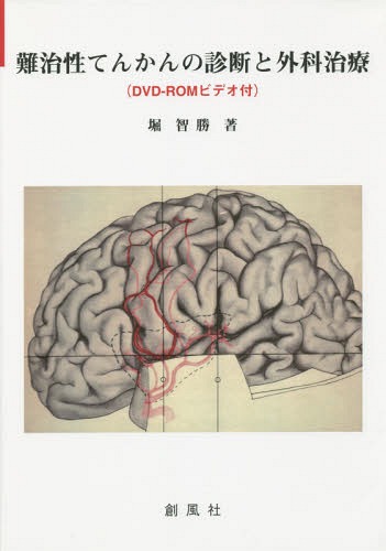 [書籍]/難治性てんかんの診断と外科治療/堀智勝/著/NEOBK-1842140