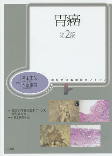 [書籍]/胃癌 第2版 (腫瘍病理鑑別診断アトラス)/深山正久/編集 大倉康男/編集 腫瘍病理鑑別診断アトラス刊行委員会/監修/NEOBK-1876670