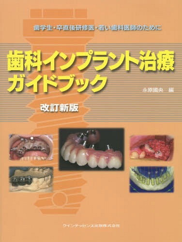 [書籍]/歯科インプラント治療ガイドブック 歯学生・卒直後研修医・若い歯科医師のために/永原國央/編/NEOBK-1893780