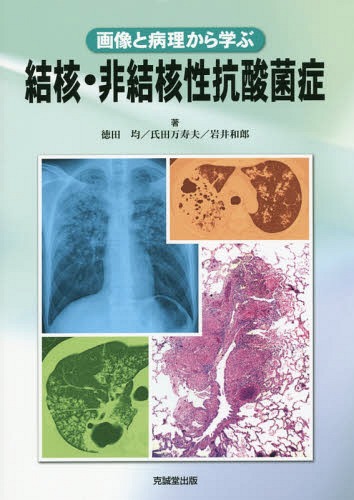 [書籍]/画像と病理から学ぶ結核・非結核性抗酸菌症/徳田均/著 氏田万寿夫/著 岩井和郎/著/NEOBK-1942604
