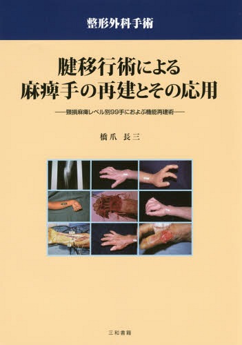 [書籍]/腱移行術による麻痺手の再建とその応用 頸損麻痺レベル別99手におよぶ機能再建術 整形外科手術/橋爪長三/著/NEOBK-1947026 6,930円