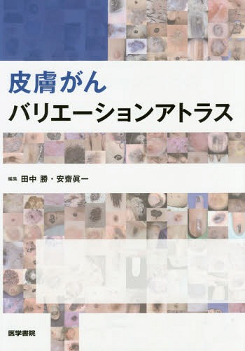 [書籍]/皮膚がんバリエーションアトラス/田中勝/編集 安齋眞一/編集/NEOBK-1949913