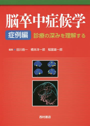 [書籍]/脳卒中症候学 症例編/田川皓一/編集 橋本洋一郎/編集 稲富雄一郎/編集/NEOBK-1958066