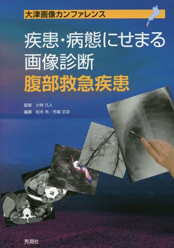 [書籍]/疾患・病態にせまる画像診断腹部救急疾患 大津画像カンファレンス/小林久人/監修 松木充/編著 市場文功/編著/NEOBK-2004000