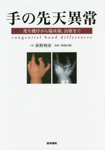 [書籍]/手の先天異常 発生機序から臨床像治療まで/荻野利彦/著 阿部宗昭/監修/NEOBK-2013437