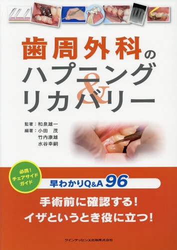 書籍]/歯周外科のハプニング&リカバリー 早わかりQ&A96/和泉雄一/監著