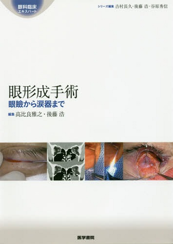書籍]/眼形成手術 眼瞼から涙器まで (眼科臨床エキスパート)/高比良