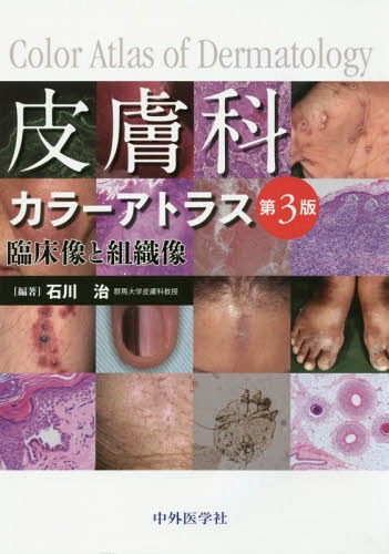 [書籍]/皮膚科カラーアトラス 第3版 臨床像と組/石川治/編著/NEOBK-2057092