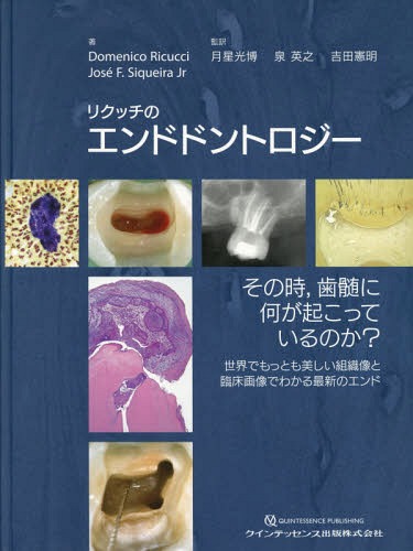 [書籍]/リクッチのエンドドントロジー その時歯髄に何が起こっているのか? 世界でもっとも美しい組織像と臨床画像でわかる最新のエンド / 原タイトル:Patologia e Clinica Endodontica(重訳) 原タイトル:Endodontology/DomenicoRicucci/著 JoseF.SiqueiraJr/著 月星光博/監訳