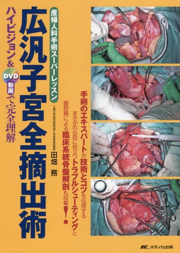[書籍]/広汎子宮全摘出術 ハイビジョン&amp;DVD動画で完全理解 産婦人科手術スーパーレッスン/田畑務/著/NEOBK-2086057
