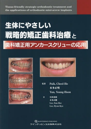[書籍]/生体にやさしい戦略的矯正歯科治療と歯科矯正用アンカースクリューの応用/PaikCheol‐Ho/監著 本多正明/監著 YunYoung‐Hoon/監著 中西秀郎/〔ほか〕著/NEOBK-2091333