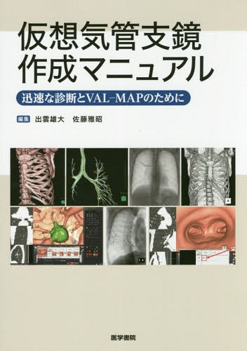 [書籍]/仮想気管支鏡作成マニュアル 迅速な診断とVAL-MAPのために/出雲雄大/編集 佐藤雅昭/編集/NEOBK-2100488