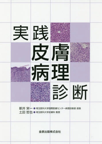[書籍]/実践皮膚病理診断/新井栄一/著 土田哲也/著/NEOBK-2102323