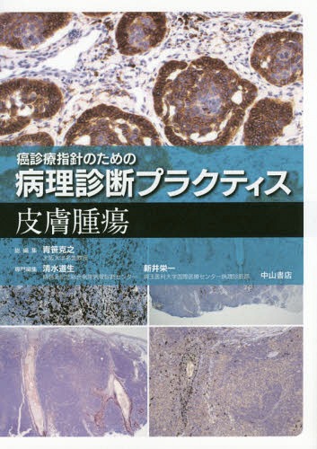 [書籍]/皮膚腫瘍 (癌診療指針のための病理診断プラクティス)/清水道生/専門編集 新井栄一/専門編集/NEOBK-2132451