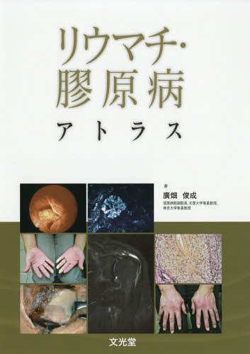 [書籍]/リウマチ・膠原病アトラス/廣畑俊成/著/NEOBK-2220307