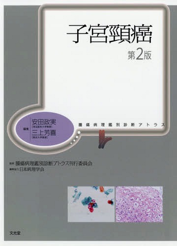 [書籍]/子宮頸癌 第2版 (腫瘍病理鑑別診断アトラス)/安田政実/編集 三上芳喜/編集 腫瘍病理鑑別診断アトラス刊行委員会/監修/NEOBK-2235751
