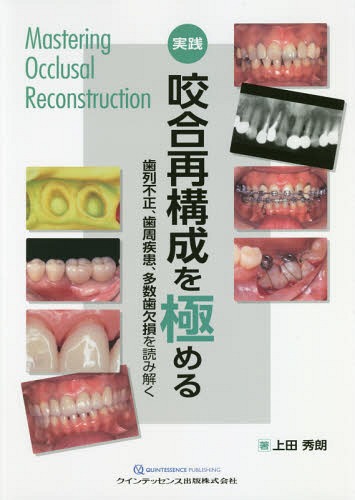 [書籍]/実践咬合再構成を極める 歯列不正、歯周疾患、多数歯欠損を読み解く/上田秀朗/著/NEOBK-2248995 10,296円
