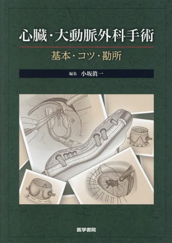 書籍]/心臓・大動脈外科手術 基本・コツ・勘所/小坂眞一/編集/NEOBK