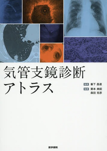 [書籍]/気管支鏡診断アトラス/峯下昌道/監修 栗本典昭/執筆 森田克彦/執筆/NEOBK-2303687