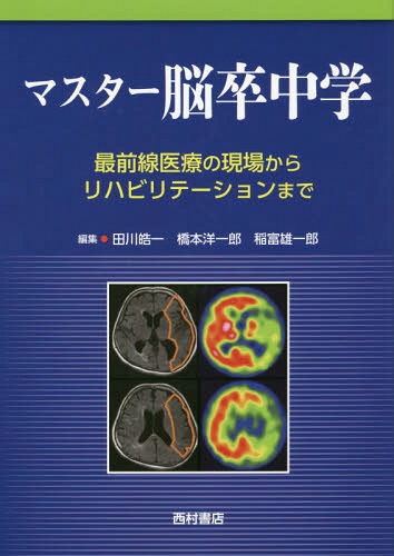 [書籍]/マスター脳卒中学 最前線医療の現場からリハビリテーションまで/田川皓一/編集 橋本洋一郎/編集 稲富雄一郎/編集/NEOBK-2332141