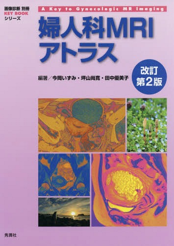 [書籍]/婦人科MRIアトラス (画像診断別冊KEY)/今岡いずみ/編著 坪山尚寛/編著 田中優美子/編著/NEOBK-2346665