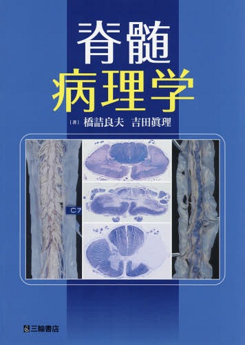 [書籍]/脊髄病理学/橋詰良夫/著 吉田眞理/著/NEOBK-2366973