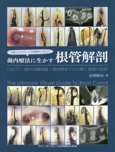 [書籍]/写真とエビデンスで歯種別に学ぶ!歯内療法に生かす根管解剖 CBCT・歯科用顕微鏡・透明標本でひも解く根管の秘密/吉岡隆知/著/NEOBK-2369516
