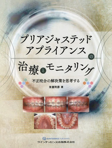 [書籍]/プリアジャステッドアプライアンスの治療とモニタリング 不正咬合の解決策を思考する/氷室利彦/著/NEOBK-2369517