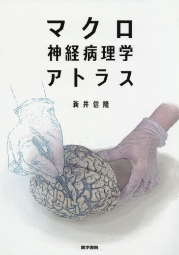 [書籍]/マクロ神経病理学アトラス/新井信隆/著/NEOBK-2384963