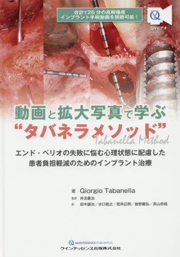 [書籍]/動画と拡大写真で学ぶ“タバネラメソッド” エンド・ペリオの失敗に悩む心理状態に配慮した患者負担軽減のためのインプラント治療 / 原タイトル:Decision Making For Retreatment Of Failures In Dental Medicine/GiorgioTabanella/著 井汲憲治/監訳 田中譲治/訳 水口