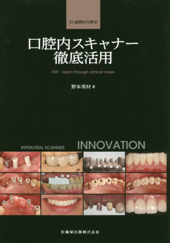 [書籍]/31症例から学ぶ口腔内スキャナー徹底活用/野本秀材/著/NEOBK-2431394