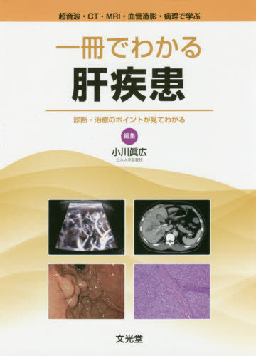[書籍]/一冊でわかる肝疾患 診断・治療のポイント (超音波・CT・MRI・血管造影・病理で学)/小川眞広/編集 杉谷雅彦/病理監修 小川眞広/〔ほか〕執筆/NEOBK-2434518