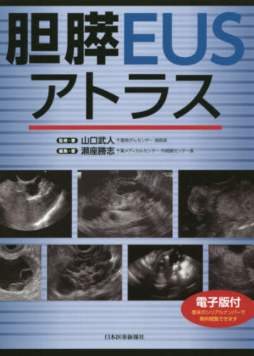 [書籍]/胆膵EUSアトラス/山口武人/監修・著 瀬座勝志/編集・著/NEOBK-2435191