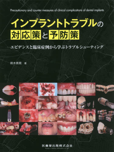 [書籍]/インプラントトラブルの対応策と予防策/鈴木貴規/著/NEOBK-2495278
