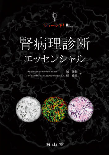 [書籍]/ジョーシキ!腎病理診断エッセンシャル/城謙輔/著 原重雄/著/NEOBK-2516416