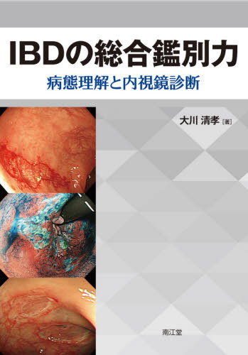 [書籍]/IBDの総合鑑別力 病態理解と内視鏡診断/大川清孝/著/NEOBK-2563419