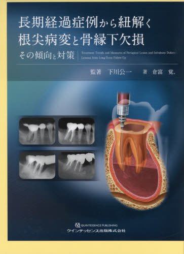 [書籍]/長期経過症例から紐解く根尖病変と骨縁下欠損 その傾向と対策/下川公一/監著 倉富覚、/著/NEOBK-2583142