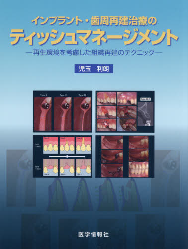 [書籍]/インプラント・歯周再建治療のティッシュマ/児玉利朗/著/NEOBK-2597609