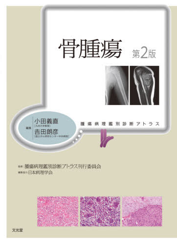 [書籍]/骨腫瘍 第2版 (腫瘍病理鑑別診断アトラス)/小田義直/編集 吉田朗彦/編集 腫瘍病理鑑別診断アトラス刊行委員会/監修 阿江啓介/〔ほか〕執筆/NEOBK-2600863