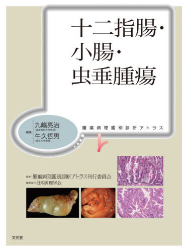 [書籍]/十二指腸・小腸・虫垂腫瘍 (腫瘍病理鑑別診断アトラス)/九嶋亮治/編集 牛久哲男/編集 腫瘍病理鑑別診断アトラス刊行委員会/監修 赤澤陽一/〔ほか〕執筆/NEOBK-2610525