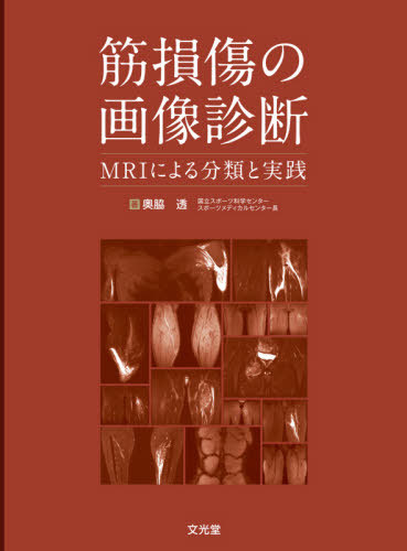 [書籍]/筋損傷の画像診断/奥脇透/著/NEOBK-2620902 6,023円