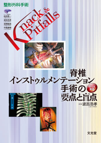[書籍]/脊椎インストゥルメンテーション手術の要点 (整形外科手術Knack&Pitfalls)/波呂浩孝/編集 寺井秀富/〔ほか〕執筆/NEOBK-2620928