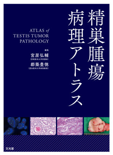 [書籍]/精巣腫瘍病理アトラス/宮居弘輔/編集 都築豊徳/編集 都築豊徳/〔ほか〕執筆/NEOBK-2633125