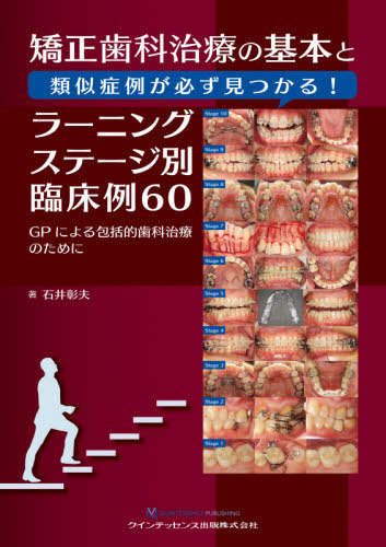 [書籍]/矯正歯科治療の基本と類似症例が必ず見つかる!ラーニングステージ別臨床例60 GPによる包括的歯科治療のために/石井彰夫/著/NEOBK-2653453