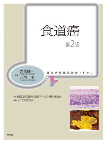 [書籍]/食道癌 第2版 (腫瘍病理鑑別診断アトラス)/大橋健一/編集 河内洋/編集 腫瘍病理鑑別診断アトラス刊行委員会/監修 相田順子/〔ほか〕執筆/NEOBK-2656884