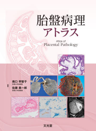 [書籍]/胎盤病理アトラス/南口早智子/編集 佐藤勇一郎/編集 南口早智子/〔ほか〕執筆/NEOBK-2667961