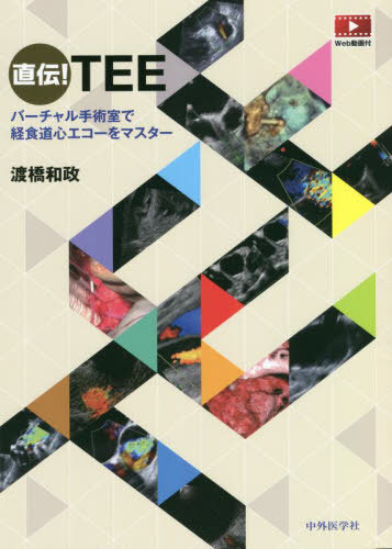 [書籍]/直伝!TEE/渡橋和政/著/NEOBK-2720929