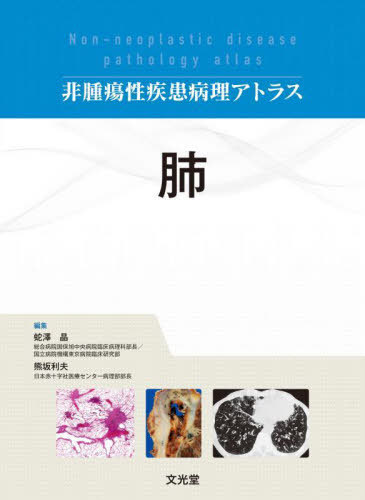 [書籍]/非腫瘍性疾患病理アトラス 肺/蛇澤晶/編集 熊坂利夫/編集/NEOBK-2731521
