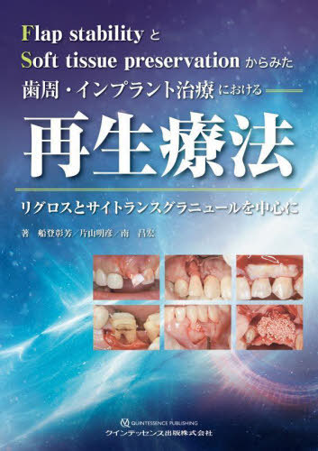 [書籍]/歯周・インプラント治療における再生療法 Flap stabilityとSoft tissue preservationからみた リグロスとサイトランスグラニュールを中心に/船登彰芳/著 片山明彦/著 南昌宏/著/NEOBK-2737887