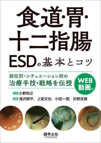 [書籍]/食道・胃・十二指腸ESDの基本とコツ 部位別・シチュエーション別の治療手技・戦略を伝授/小野裕之/監修 滝沢耕平/編集 上堂文也/編集 小田一郎/編集 矢野友規/編集/NEOBK-2738122